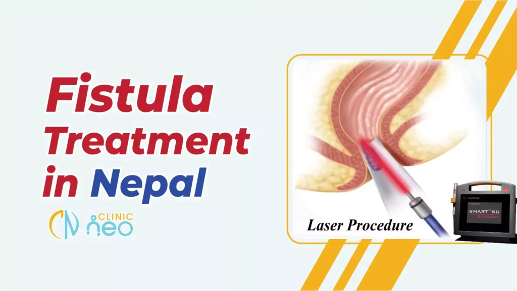 Fistula Treatment In Nepal (1)