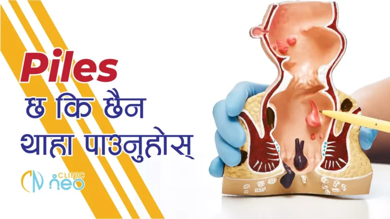 Know if you have piles or not