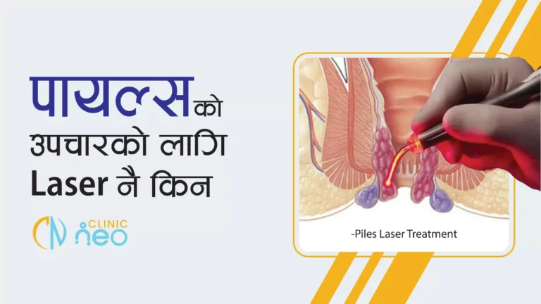 Piles को उपचारको लाग Laser नै किन