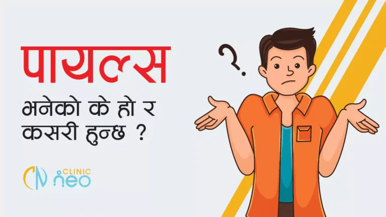 Piles भनेको के हो