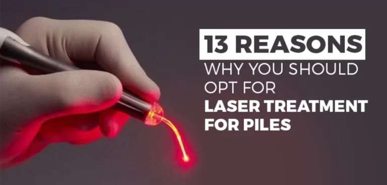 laser treatment for piles