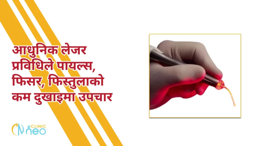 Gloved hand holding a medical laser device with a red light on, emphasizing precision. Nepali text promotes pain-relief treatments for fissures.